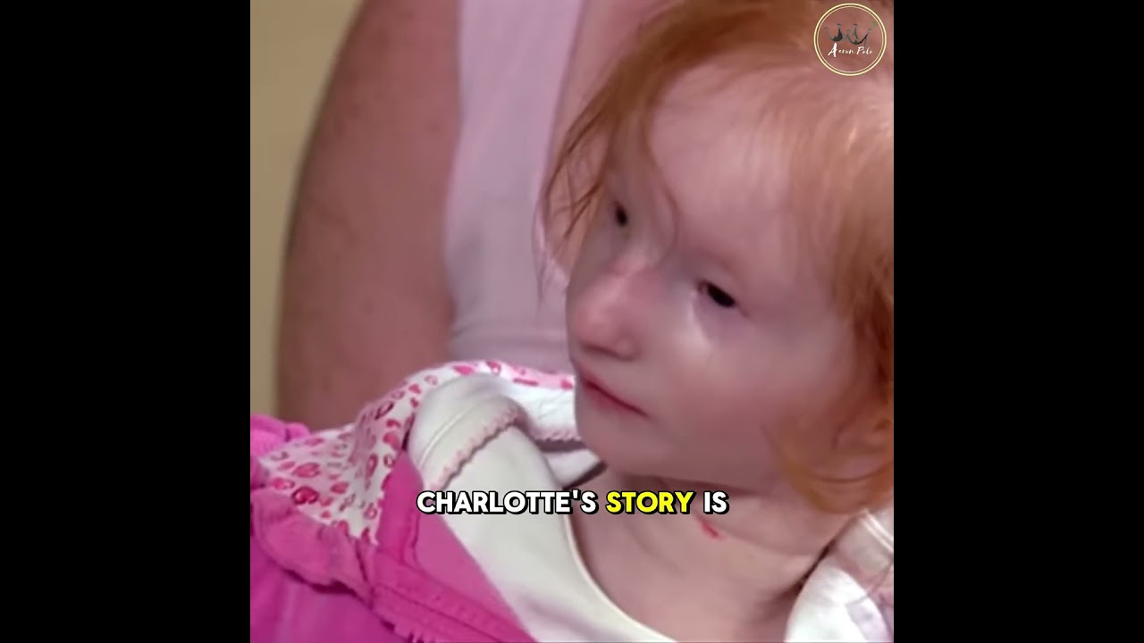 The Tiniest Girl in the World- Charlotte Garside #shorts #smallest