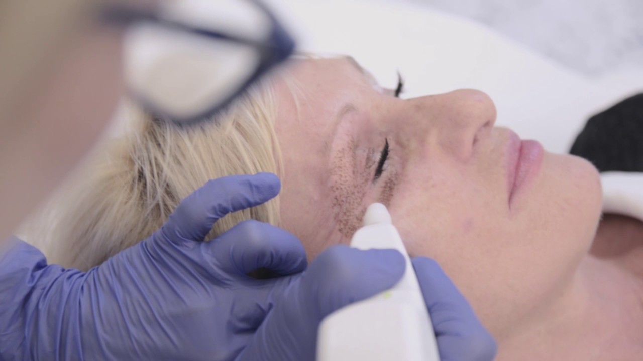 Plexr&reg; Dr Monika Bujanowska. Klinika Chirurgii Plastycznej Dr Szczyt