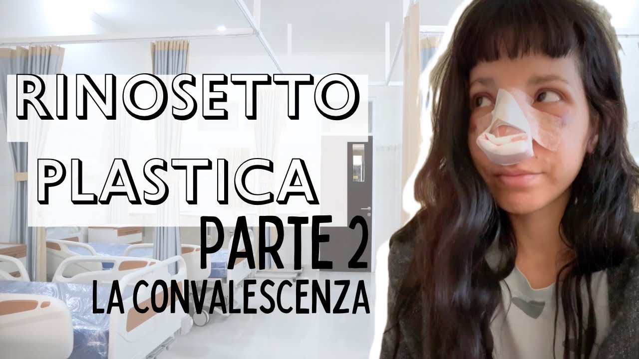 RINOSETTOPLASTICA- La mia convalescenza 