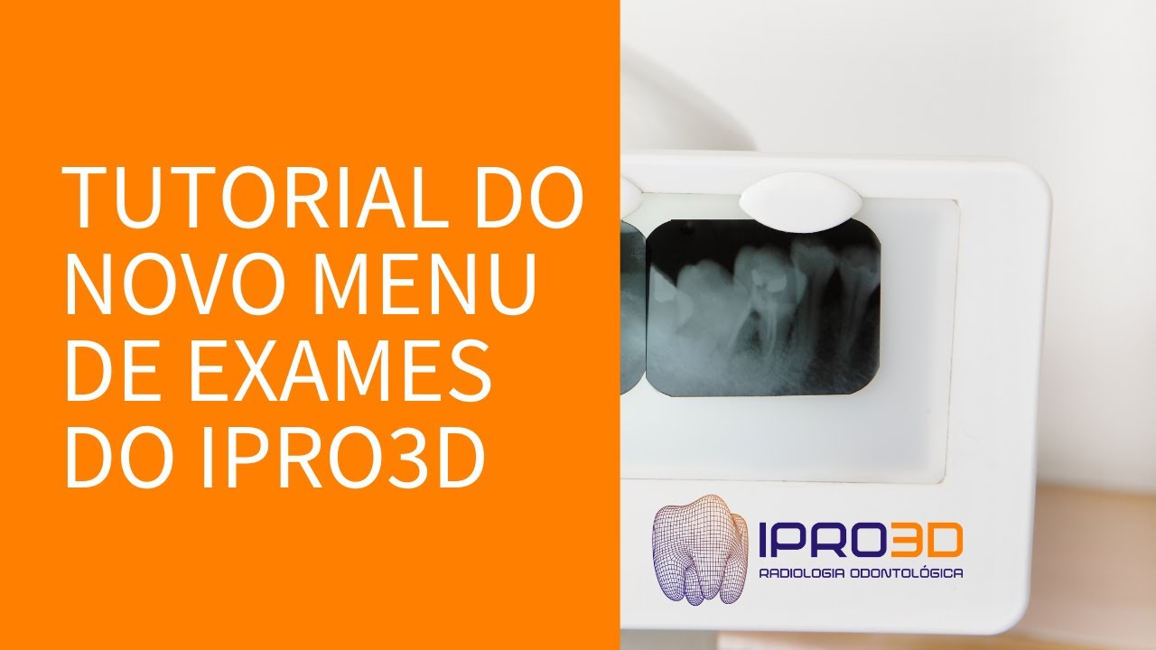 Tutorial do novo menu de exames do IPRO3D
