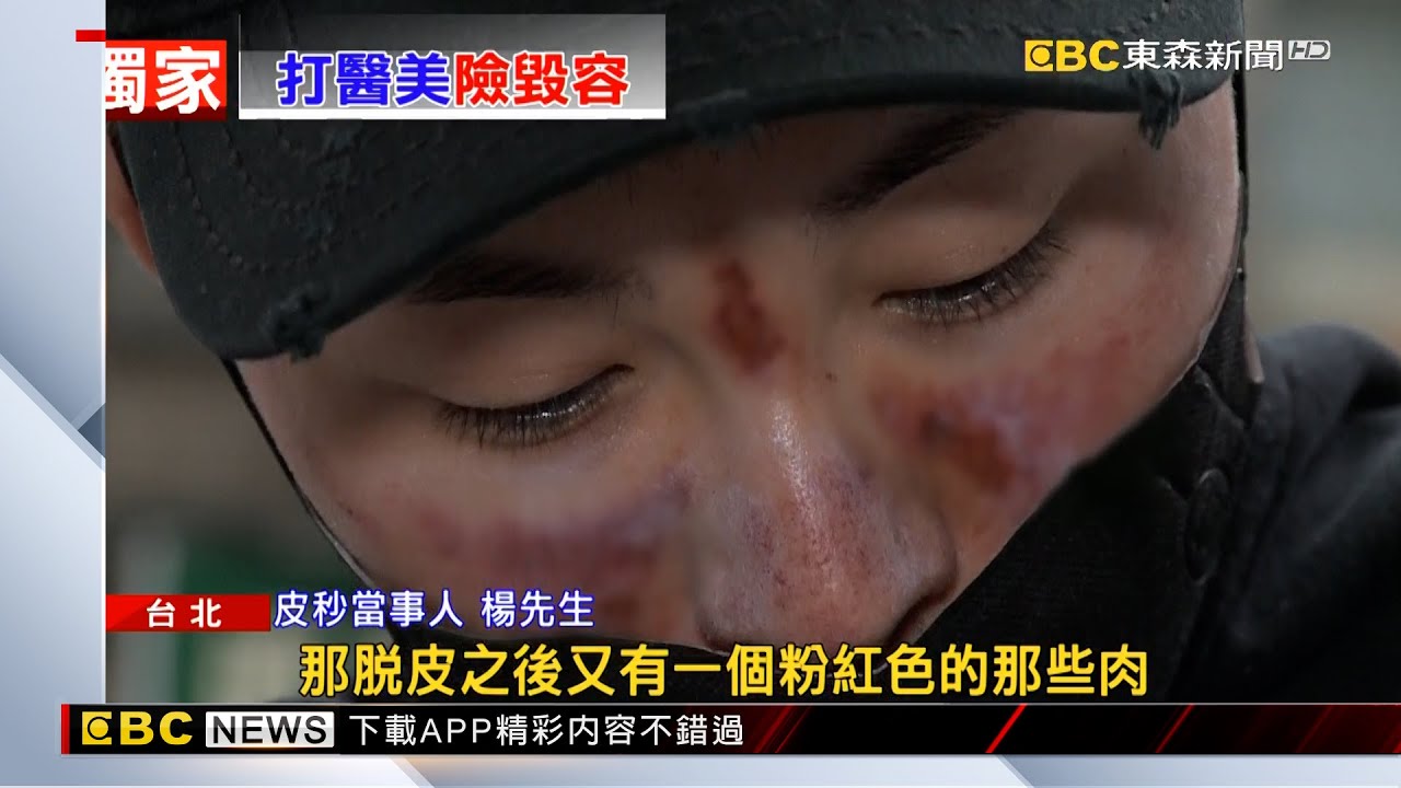 花美男打「蜂巢皮秒」燒燙傷、險毀容 控醫美診所疏失 @newsebc