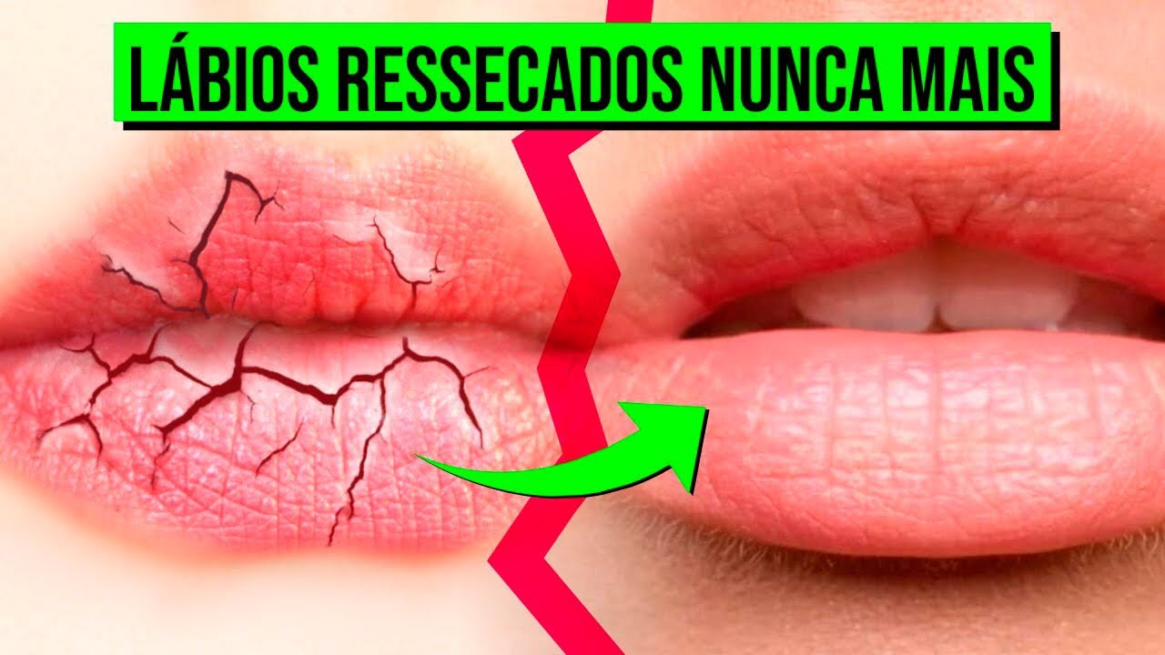 ADEUS L&Aacute;BIOS RESSECADOS E RACHADOS - APRENDA ESSE TRATAMENTO CASEIRO E R&Aacute;PIDO