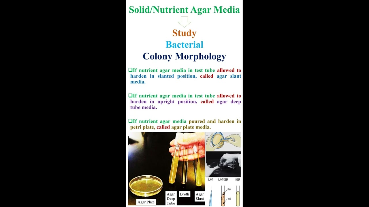 Solid or Nutrient Agar Media     