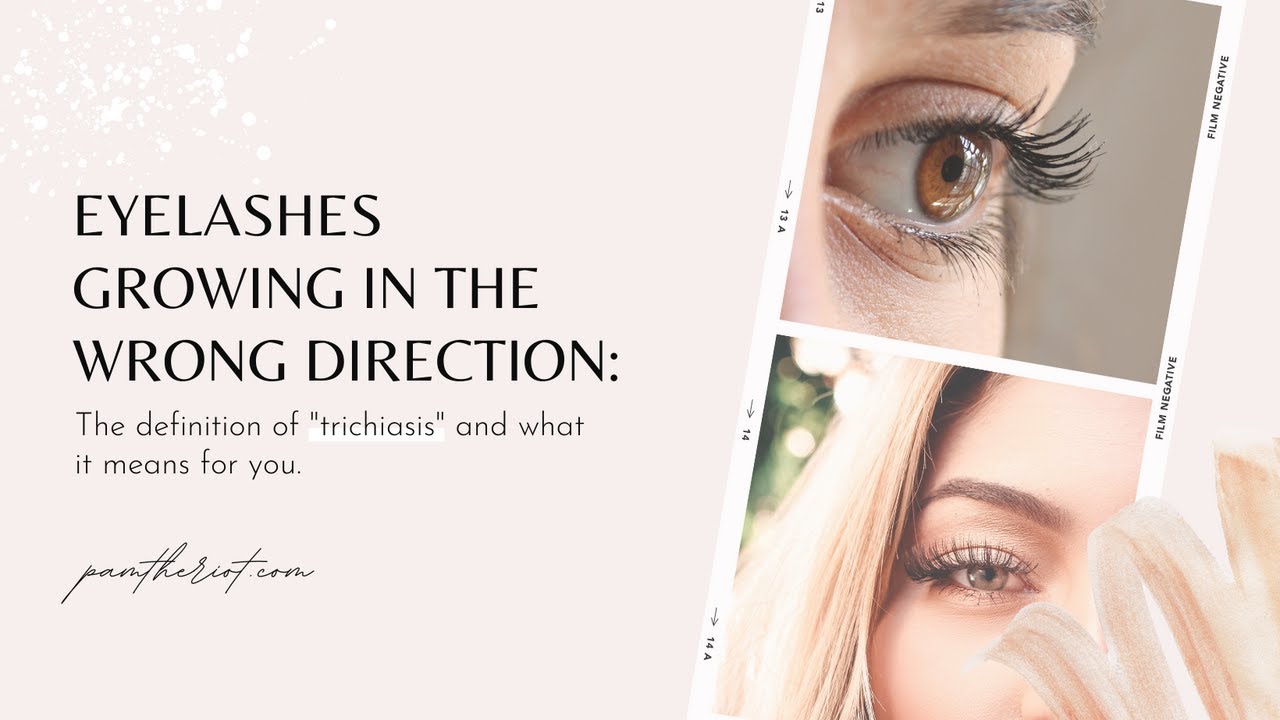 #115: Eyelashes Growing in the Wrong Direction?