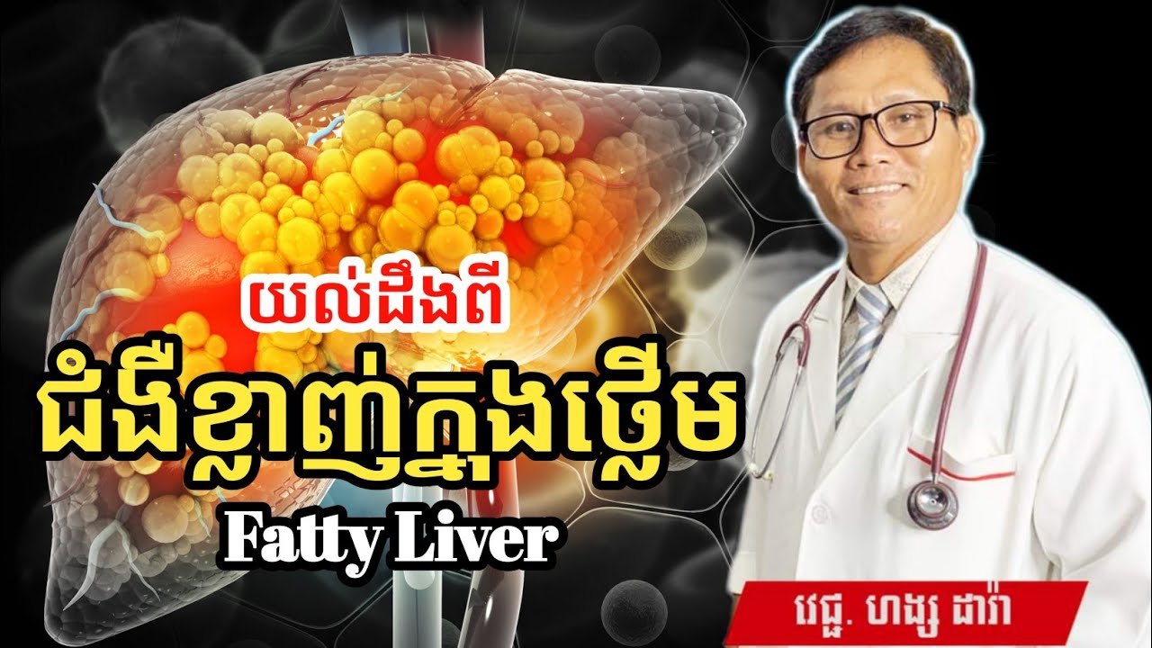 Fatty Liver ជំងឺខ្លាញ់ក្នុងថ្លើម | វេជ្ជ. ហង្ស ដារ៉ា