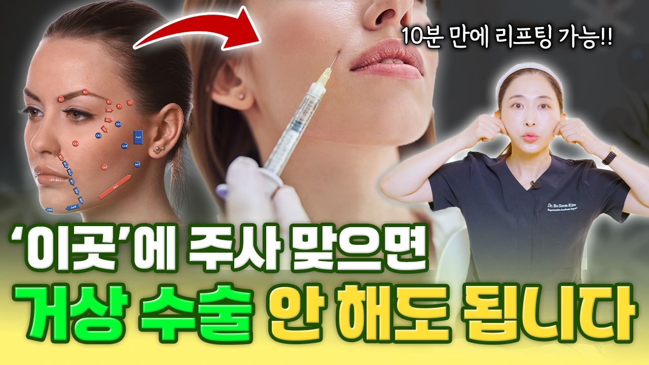 거상 수술 없이 리프팅 가능?! 인대를 강화하는 