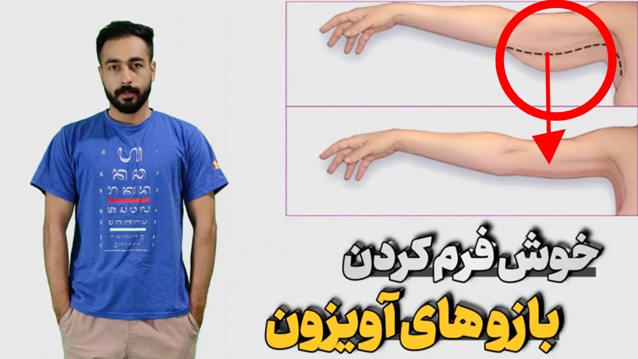 خوش فرم کردن بازو و درمان شل بودن و افتادگی بازو