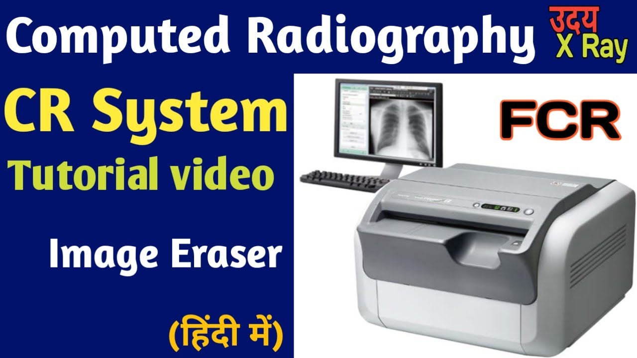 CR system tutorial video । Image Eraser process of cassette। Fujifilm CR system। Uday Xray