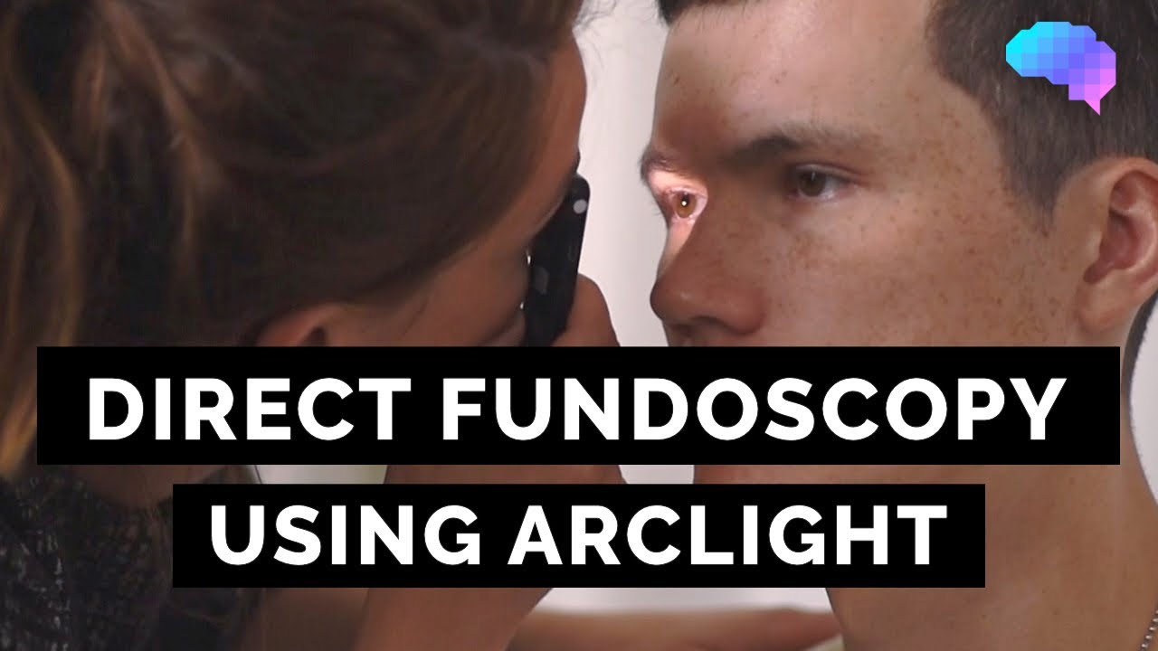 Direct Ophthalmoscopy using Arclight | OSCE Guide | UKMLA | CPSA | PLAB 2