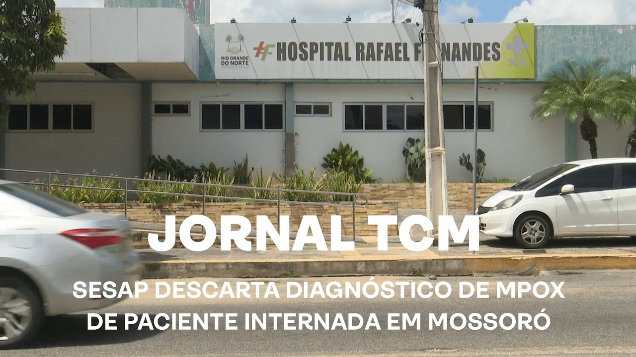 Jornal TCM - SESAP descarta diagnóstico de MPOX de paciente internada em Mossoró