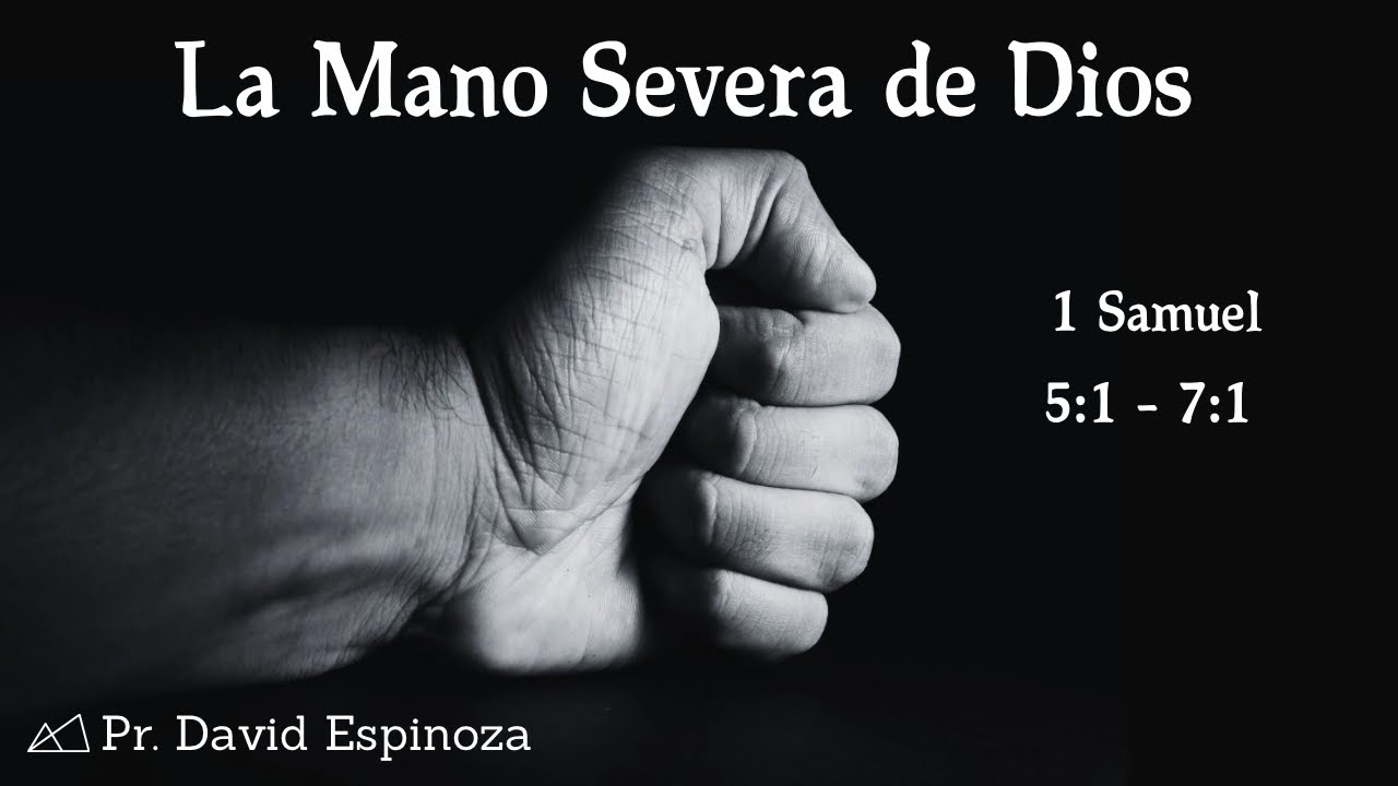 La Mano Severa De Dios