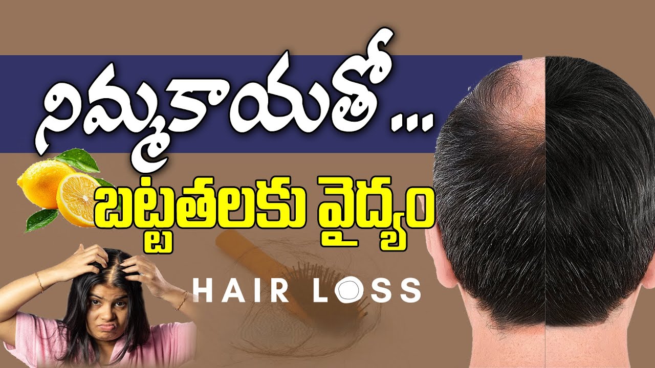 నిమ్మకాయతో బట్టతలకు వైద్యం | Hair Fall Solution at Home in Telugu | Hair Fall Control Tips