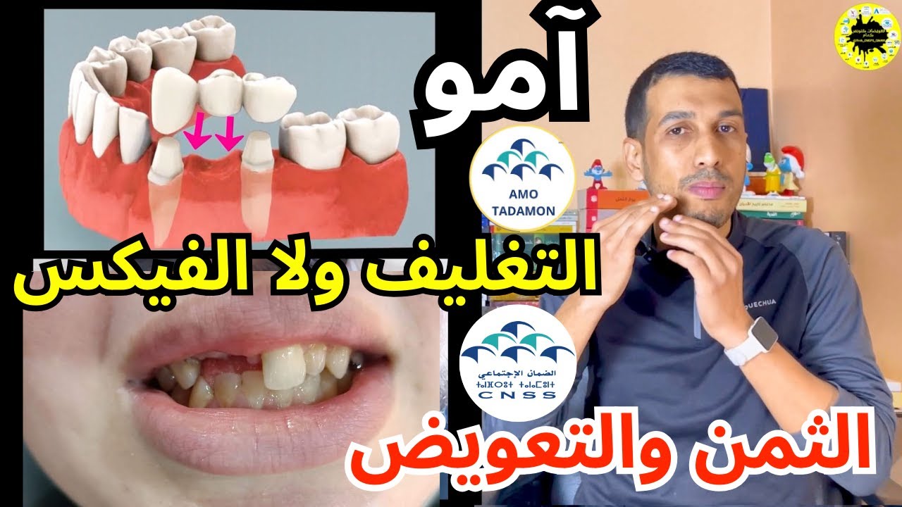 كيفاش نغلف نفيكسي سناني امو تضامن امو الشامل او نتعوض الضمان الاجتماعي AMO TADAMON AMO CHAMIL CNSS