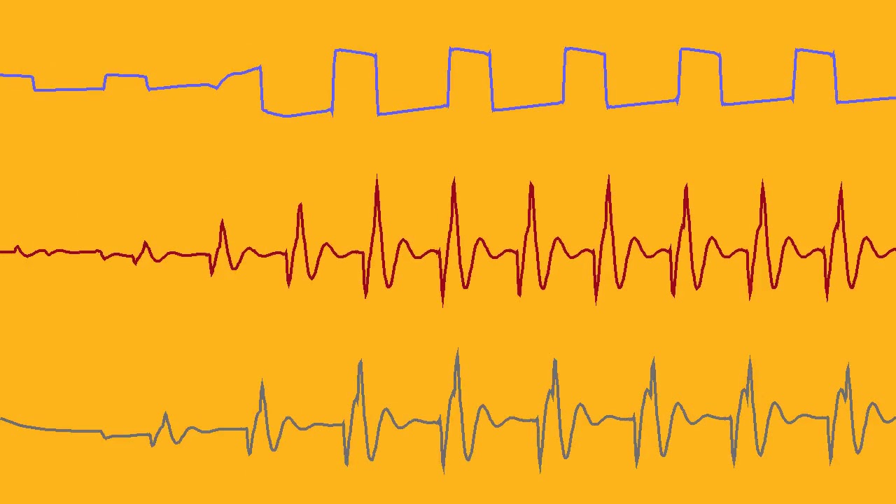 C64 SID TURRICAN Amiga on SID - Jason Page ( Oscilloscope View )