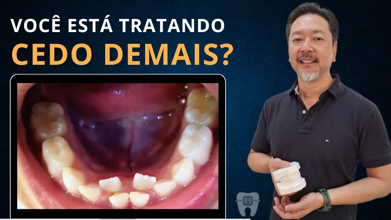 Desenvolvimento Normal ou Má Oclusão? Como Diagnosticar Alterações nos Arcos #16