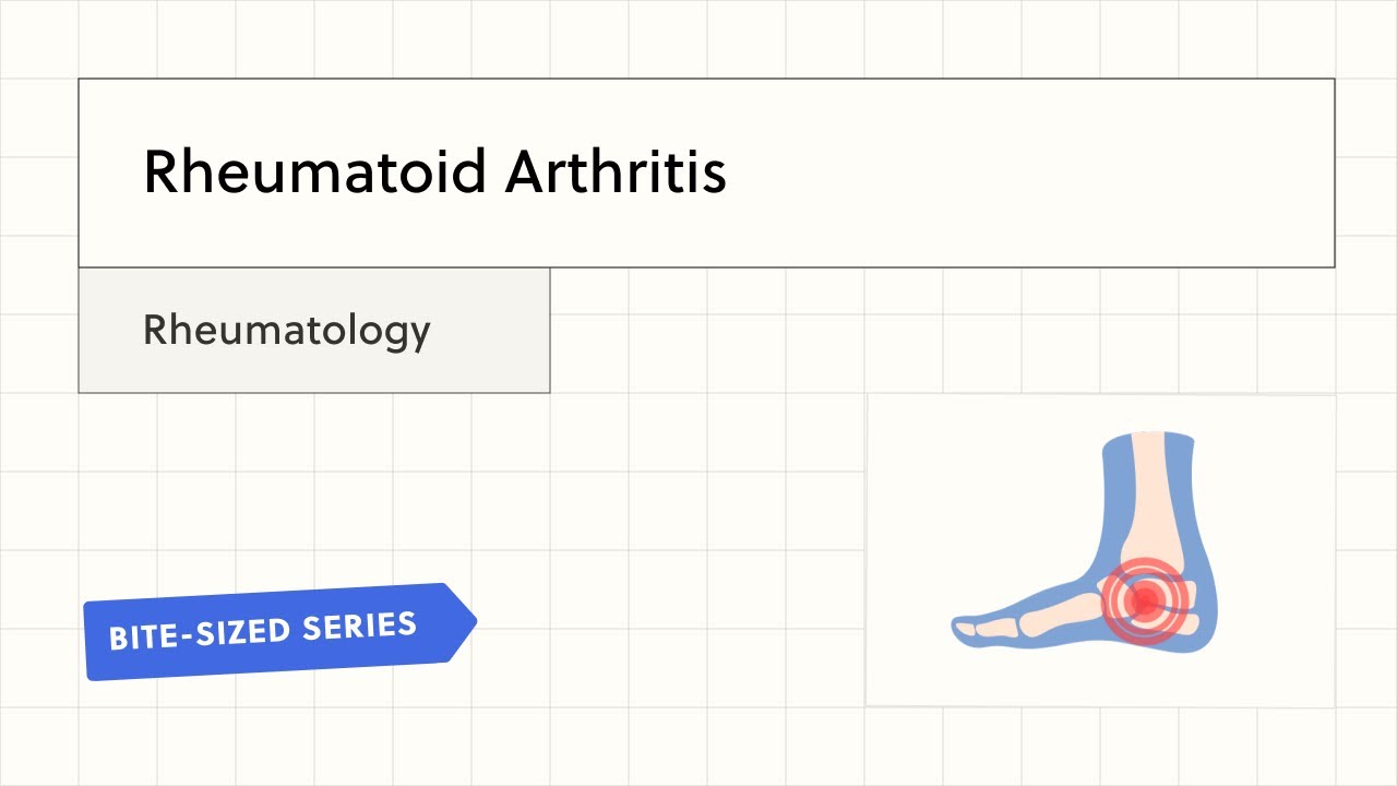 Rheumatoid Arthritis