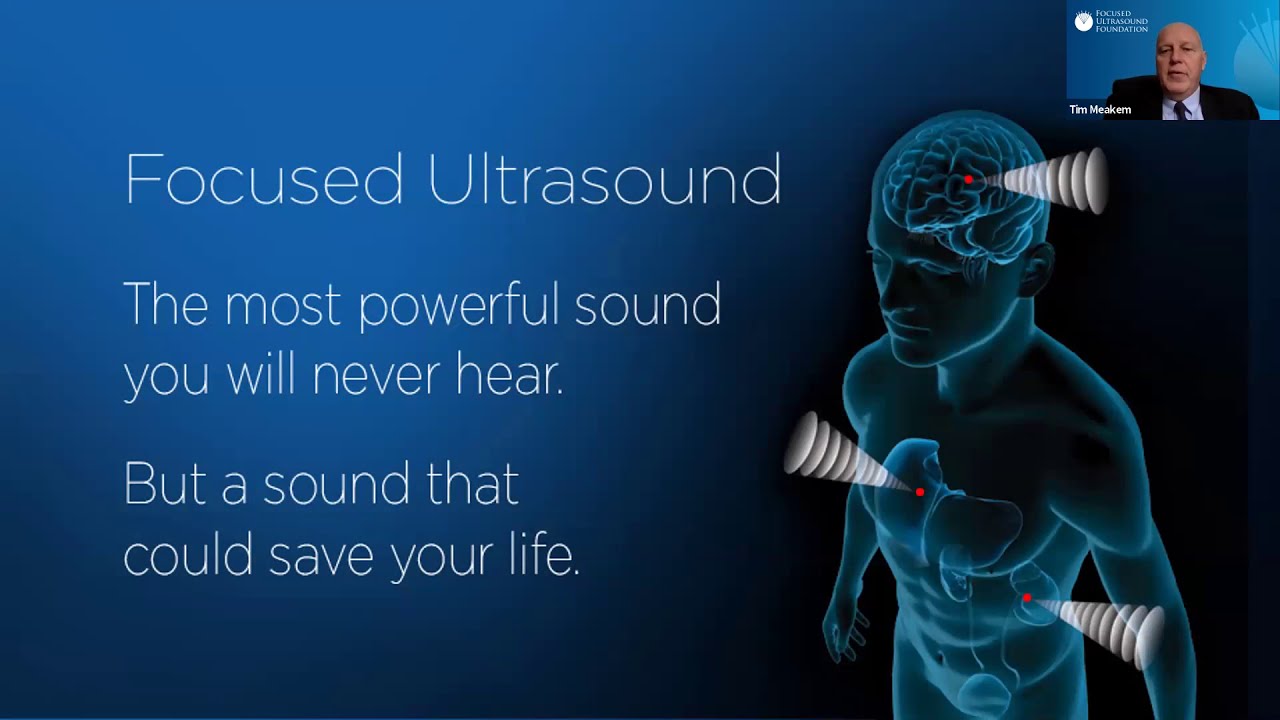 Foundation's Chief Medical Officer Discusses Focused Ultrasound for Parkinson's Disease