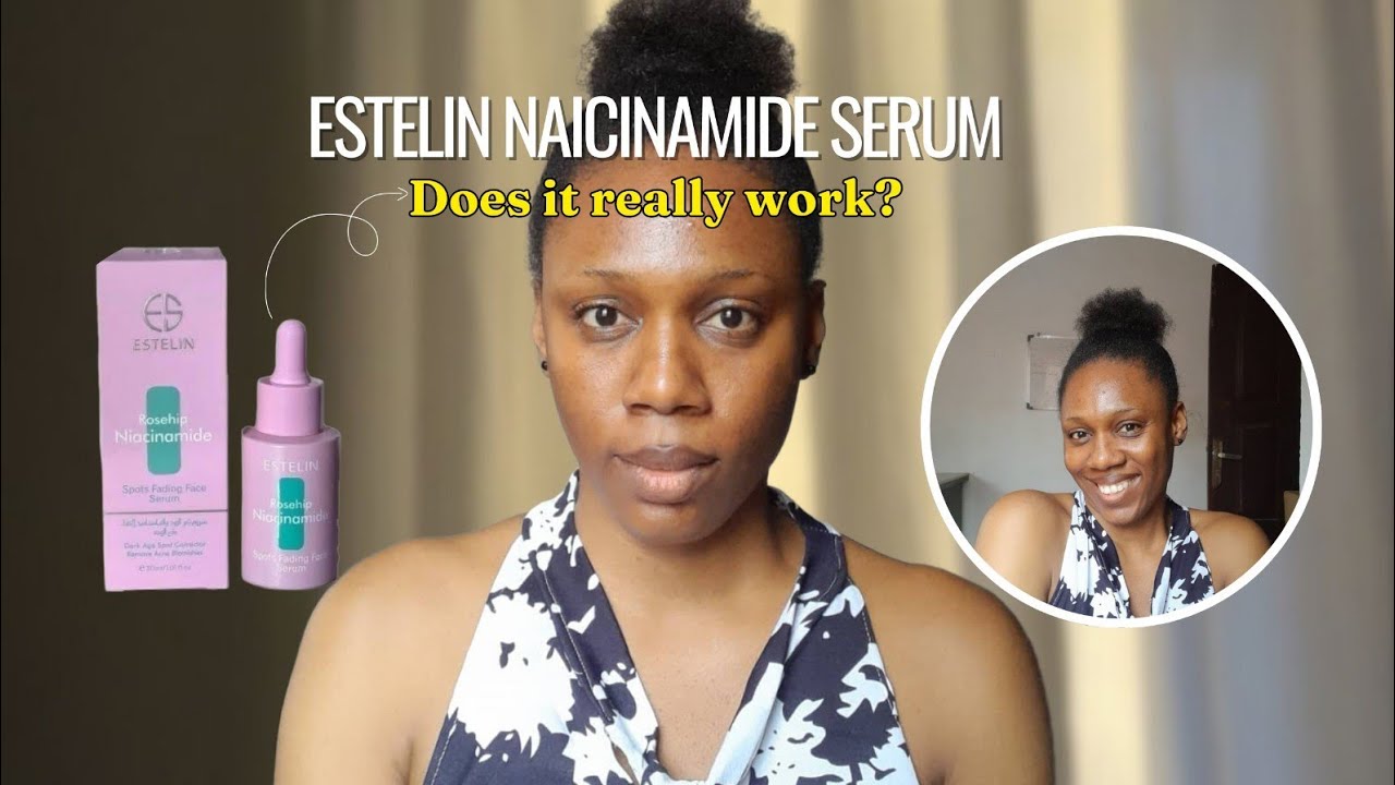 Estelin Niacinamide Serum Review | Does it really work? 