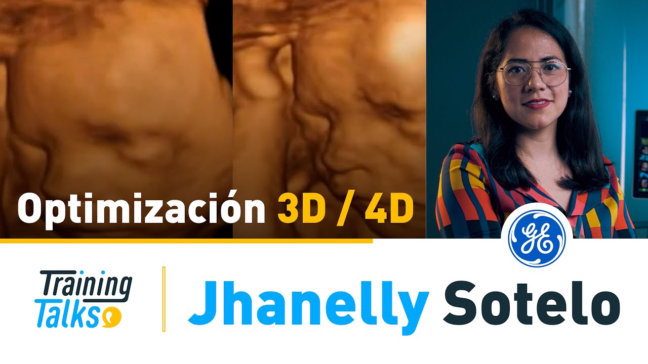¿Cómo optimizar tu imagen 3D/4D con VOLUSON? 👩‍⚕️