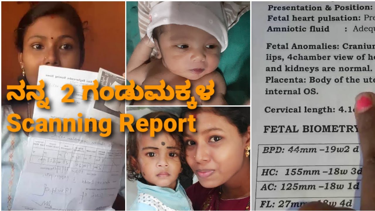 My boy Babys Full scanning report |ಗಂಡು ಹೆಣ್ಣು ಮಗು ಅಂತ ಹೇಗೆ ತಿಳಿಯುತ್ತೆ??? 🙄🤔 part 2