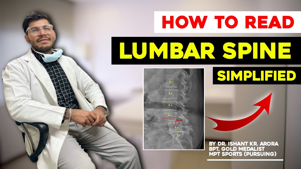 Lumbar Spine X-ray made easy | L1-S1 | Physiotherapy | Radiology | Back | Ishant Arora