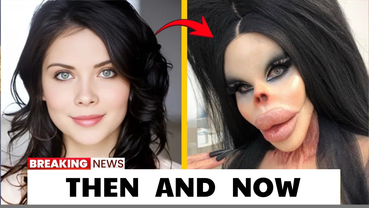 15 неудачных пластических операций, из-за которых знаменитостей не узнать тогда и сейчас (2026)