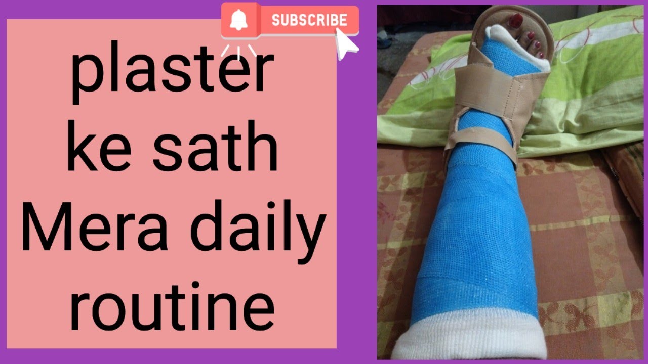 plaster ke sath Mera daily routine #vlogger #vlog #vlogging