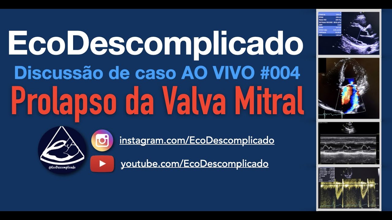 EcoDescomplicado - Discussão de caso AO VIVO #004 - Prolapso da Valva Mitral