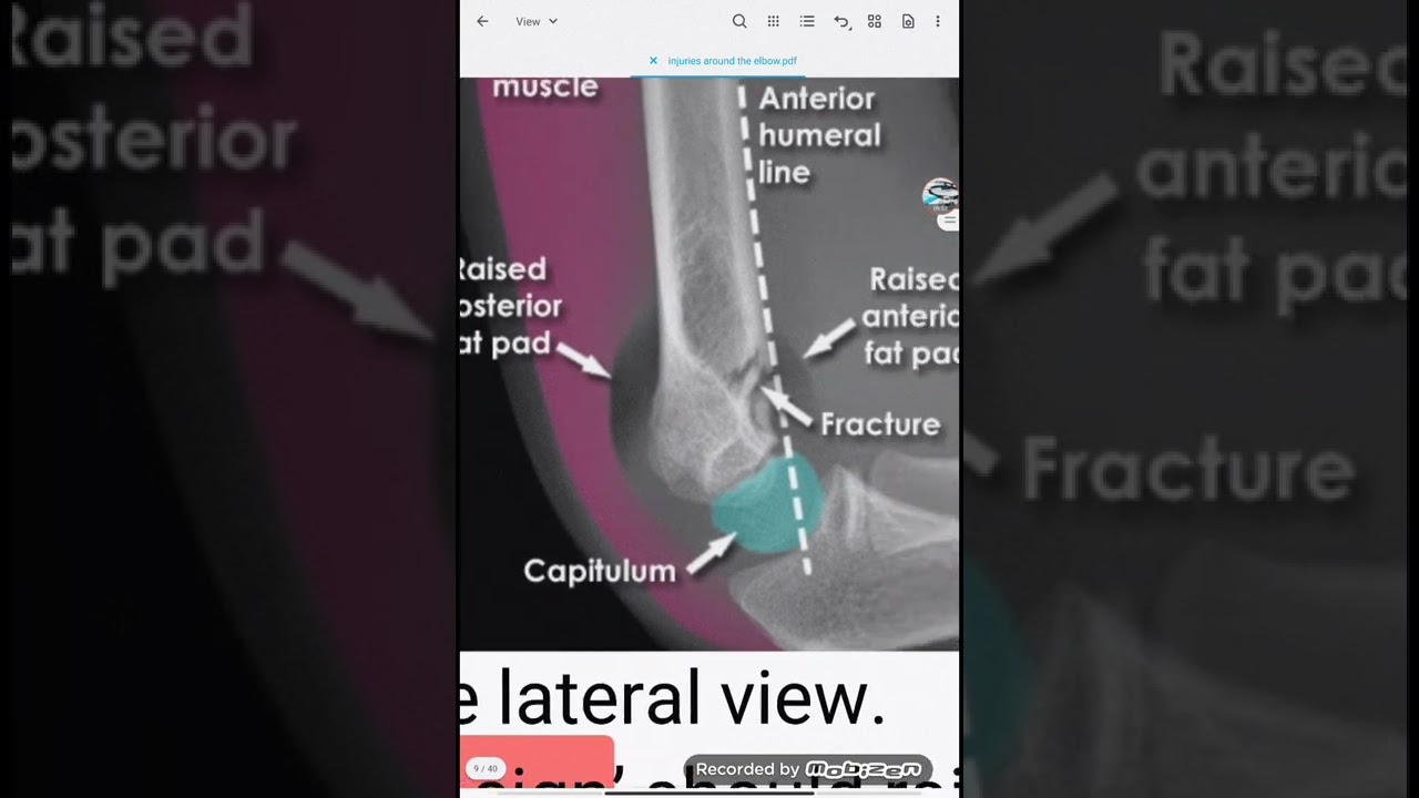 upper limbs elbow 1