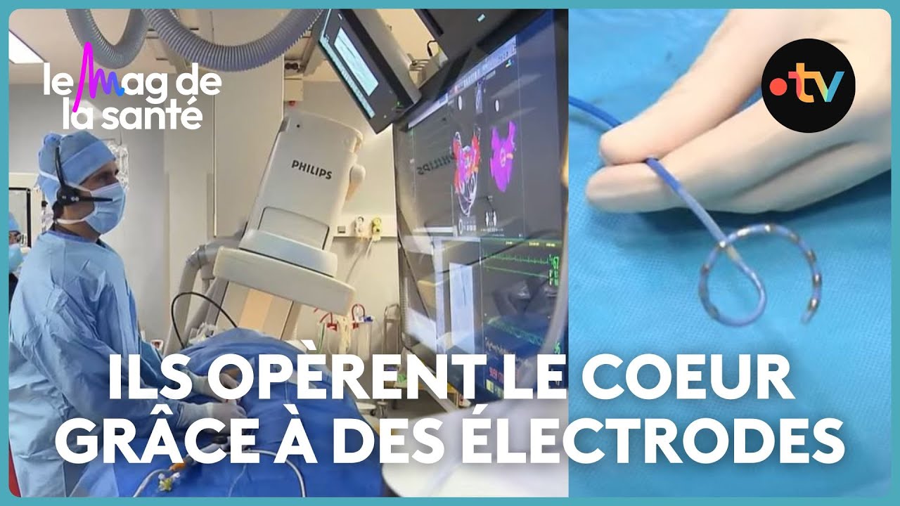 Fibrillation auriculaire, bradycardie, tachycardie : tout savoir sur l'arythmie