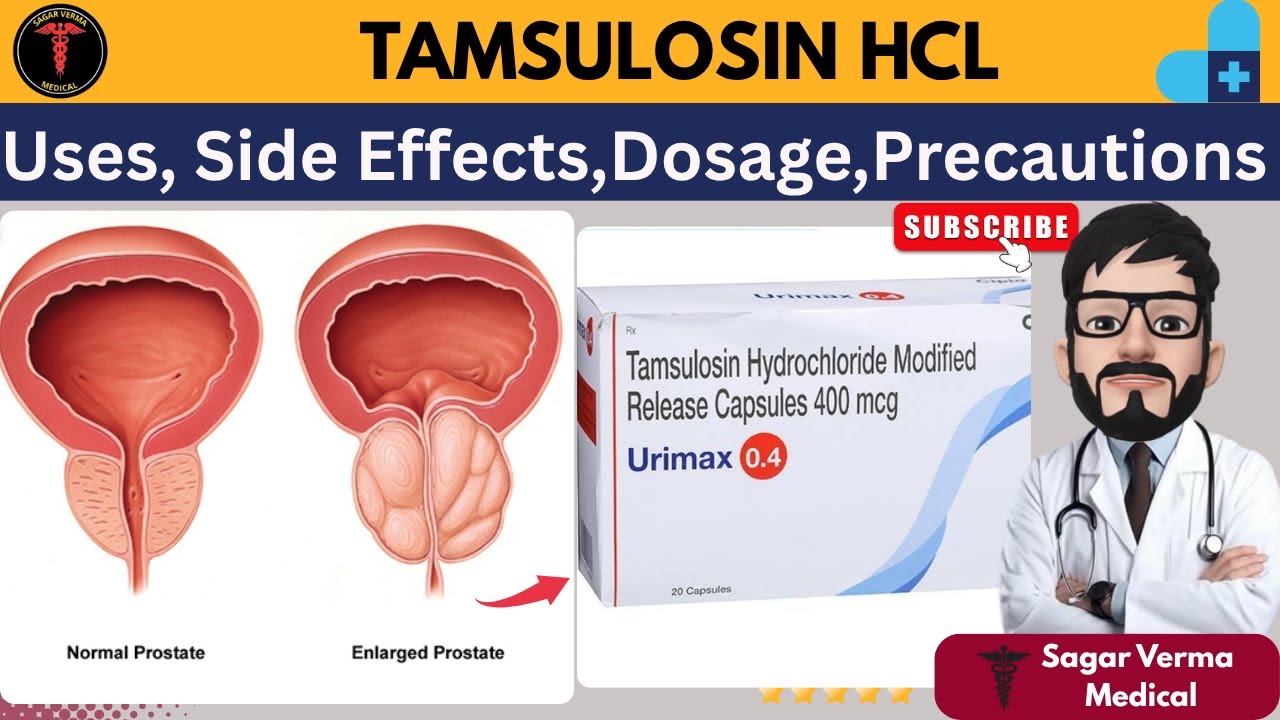 Tamsulosin hydrochloride modified release 0.4 mg uses in Hindi | Doses, uses, side effects