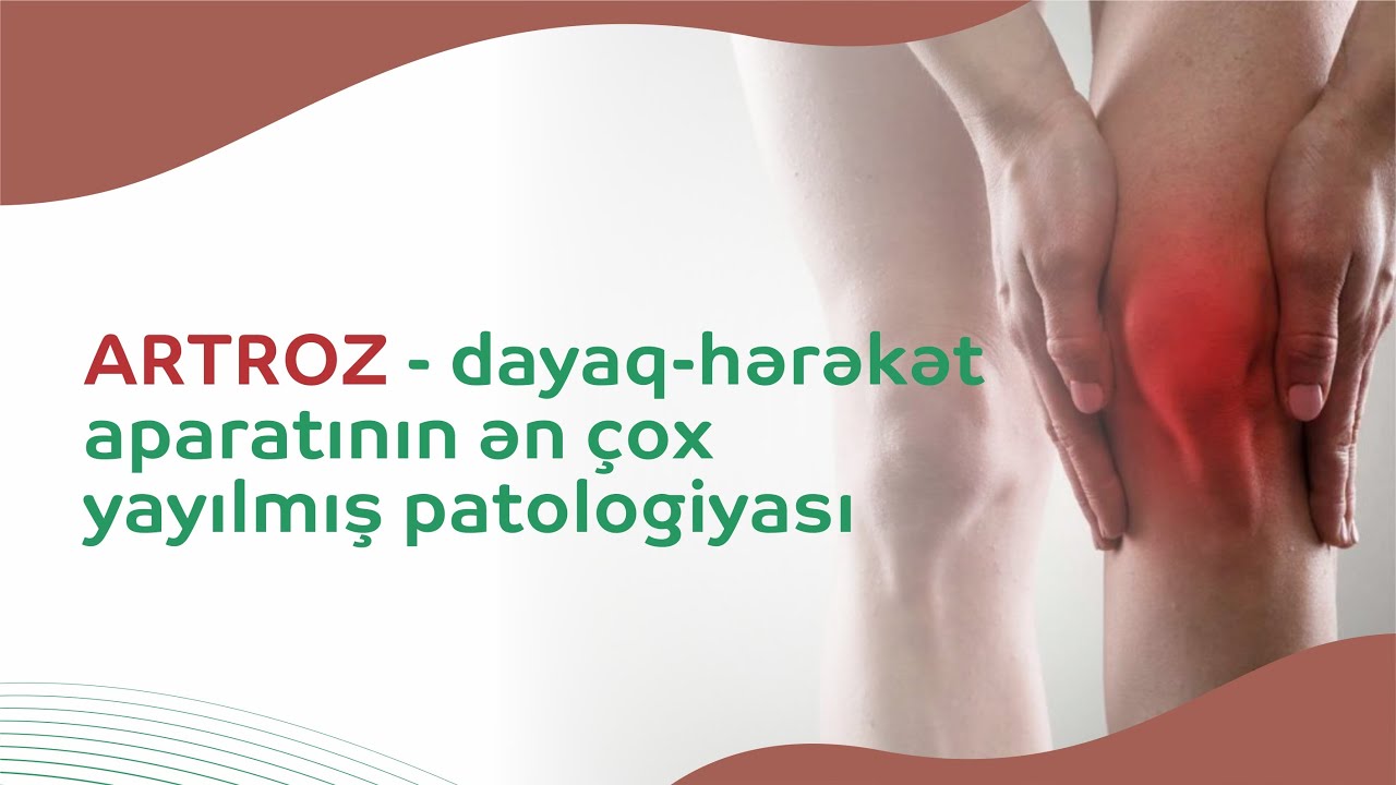 Artrozun müalicəsi və profilaktikasında İnteqrativ Tibbin üstünlükləri - Videoda izləyin #artroz