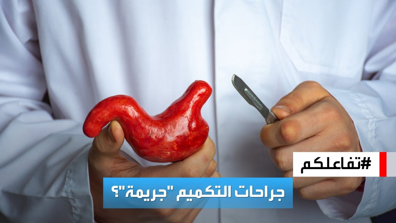 تفاعلكم | جدل حول مقطع لطبيب يعتبر جراحات التكميم 