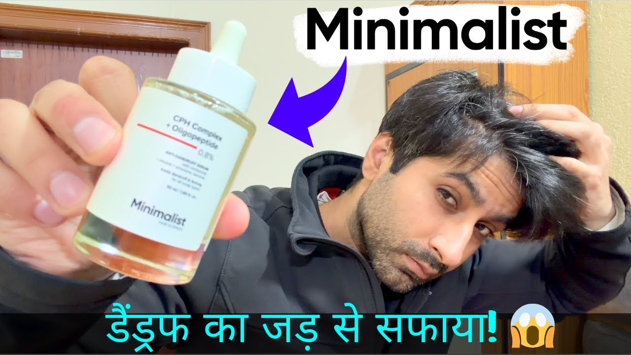 Minimalist Anti-Dandruff Serum Review #dandruff #beminimalist | dandruff ko jad se khatm kaise karen