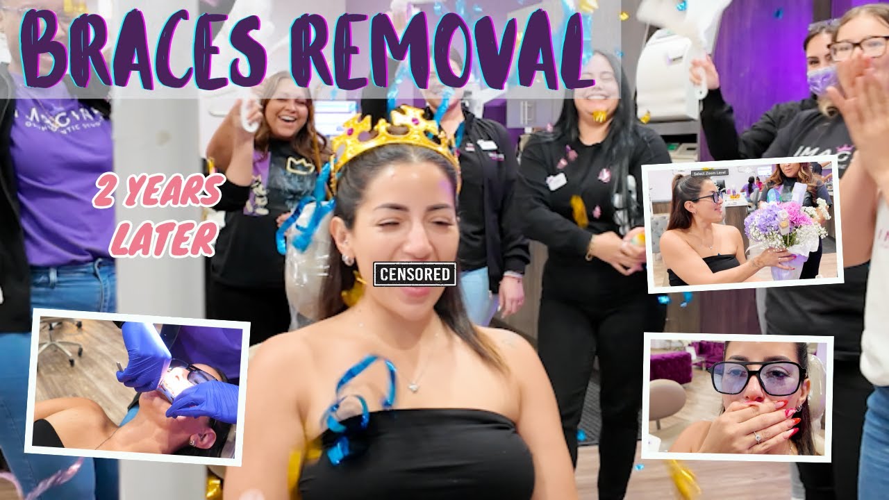 Wait Until You See My Smile… 😱 (BRACES REMOVAL VLOG)