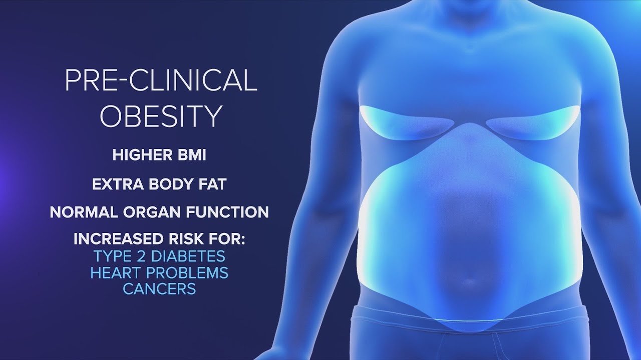 New obesity definition shifts focus from BMI to individual health and well-being