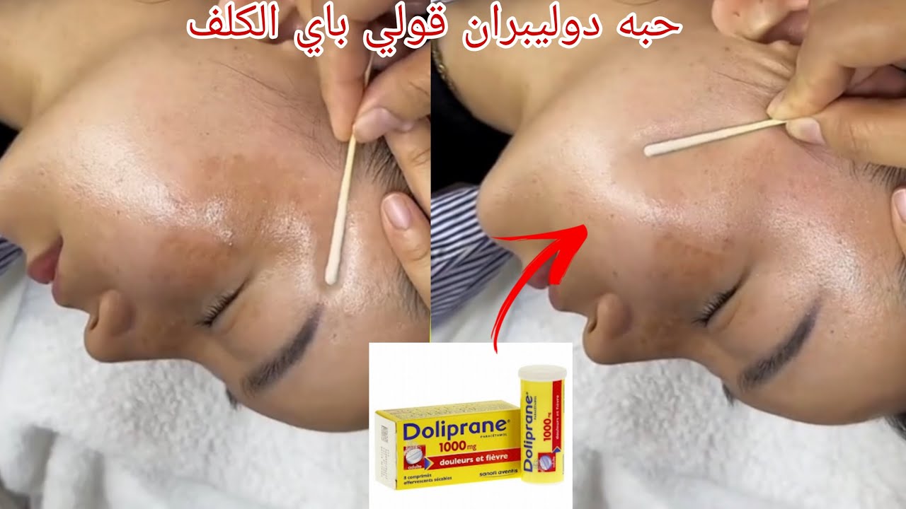 حبة دوليبران ستخلصك من التصبغات. البقع. الكلف وتجاعيد الوجه كأنك في 20 سنة من عمرك مجربة ومضمونة💯