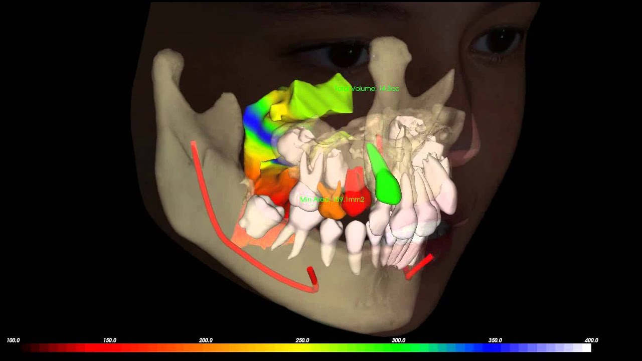Computerized Orthodontic Treatment Planning