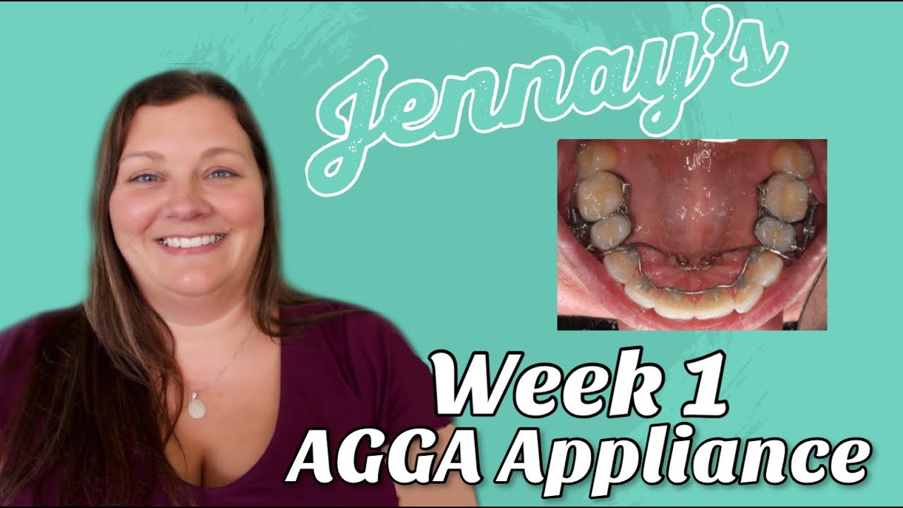 Week 1 AGGA | Jennay's Journey
