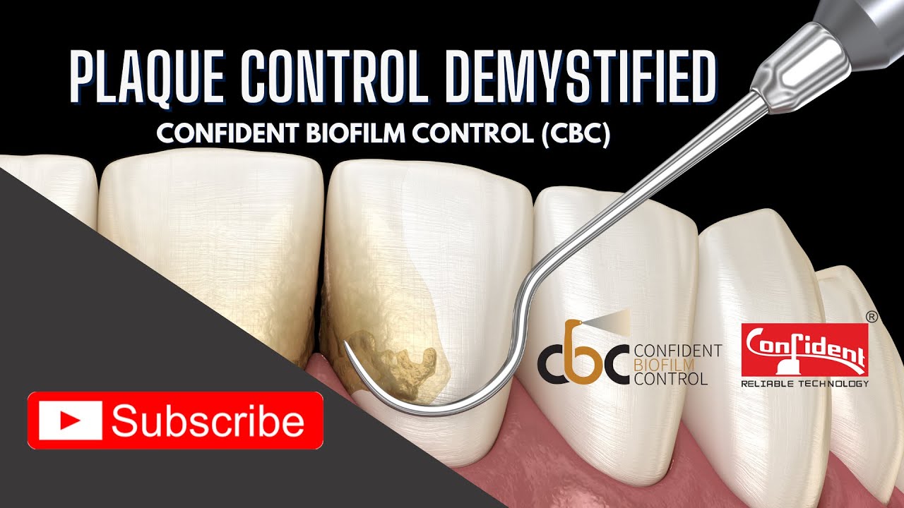Confident Biofilm Control CBC - Plaque Control Demystified #plaquecontrol #cbc