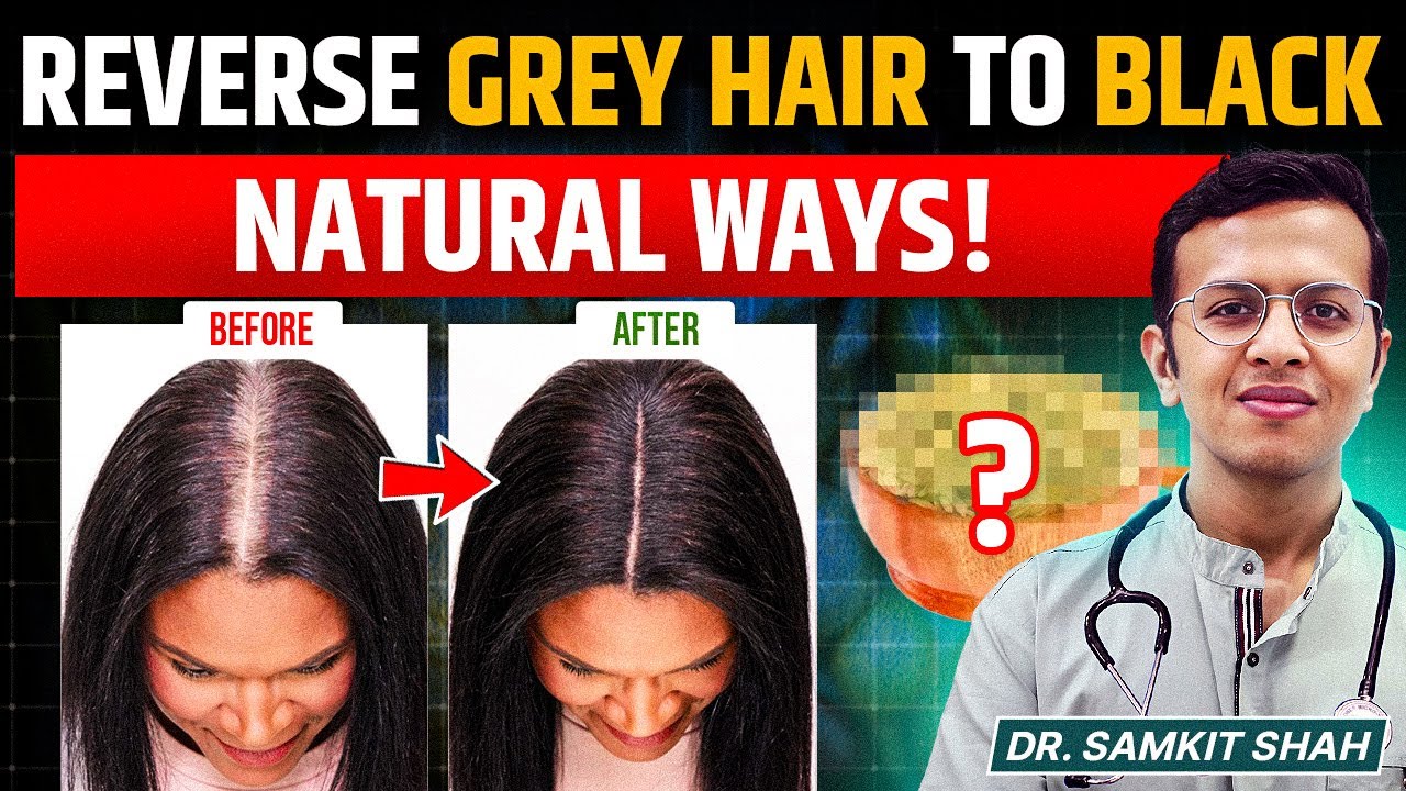 How to Reverse Grey Hair Naturally? | Turn White Hair To BLACK Hair Naturally | Dr. Samkit Shah