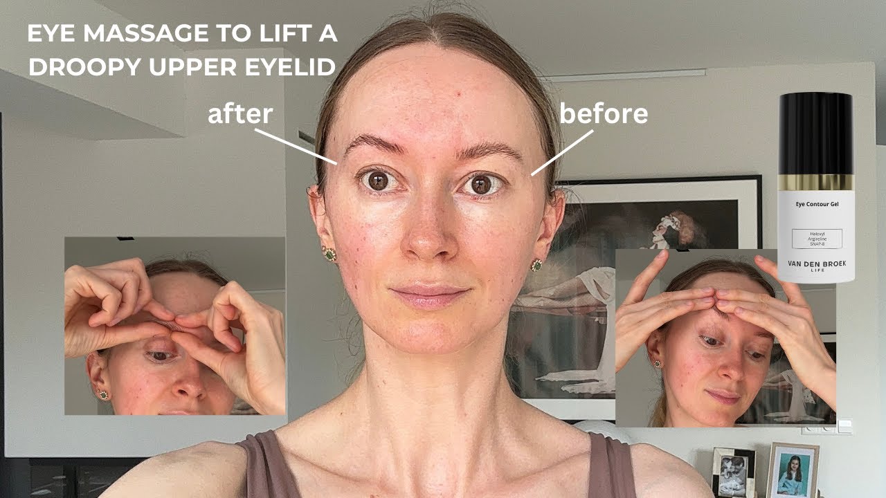 Eye massage to lift a droopy upper eyelid.