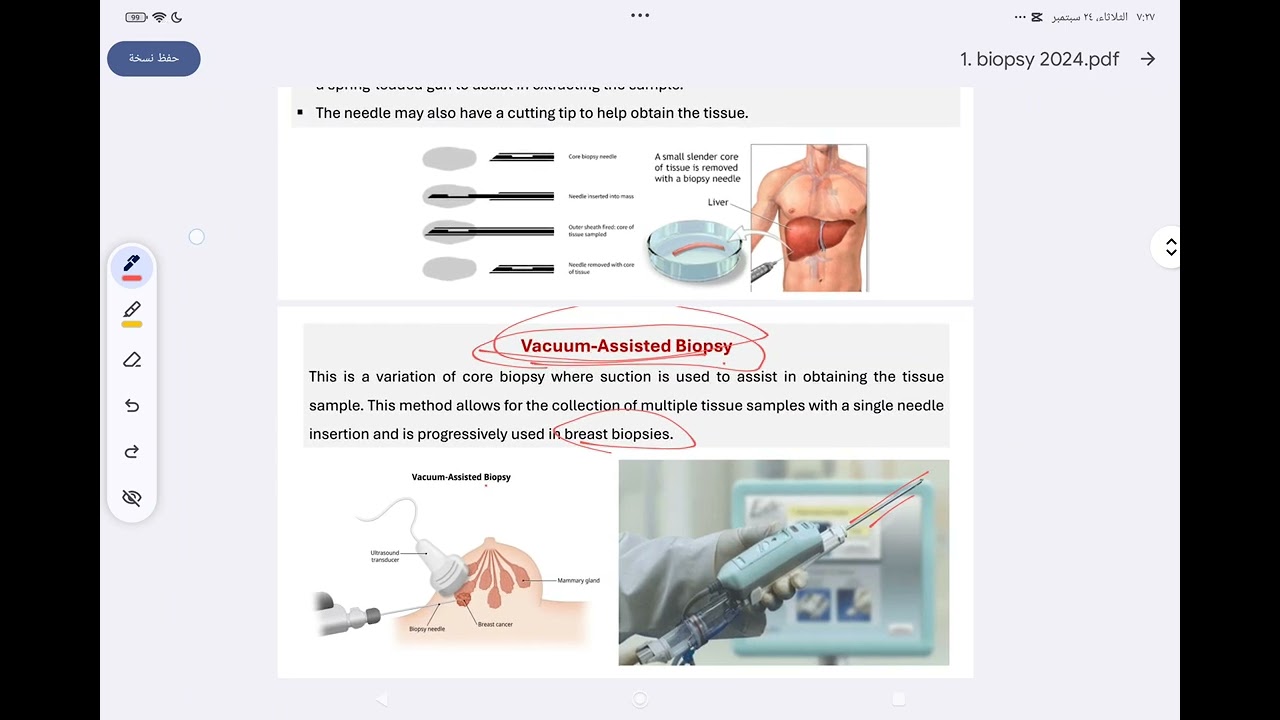 oral pathology lec 1 (Biopsy) /مرحلة رابعة طب اسنان