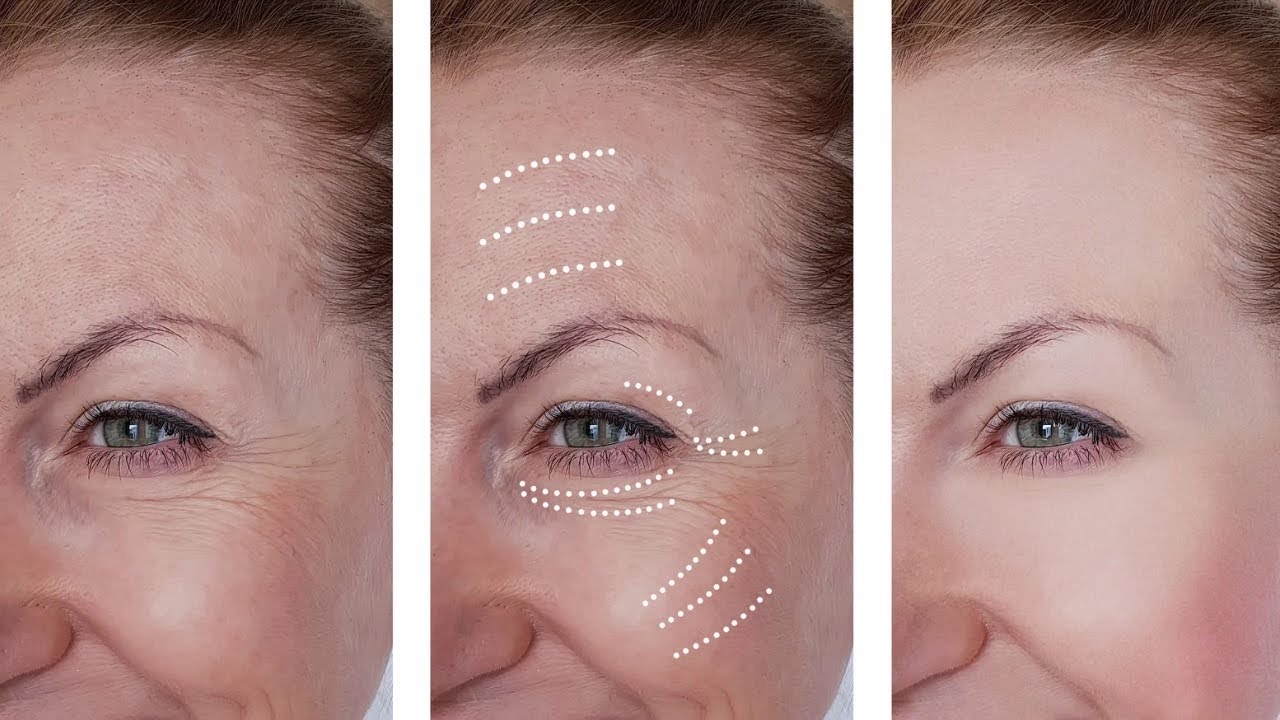 Rice Water Anti Aging Remedy | Natural Wrinkle Removal & Glowing Skin at Home