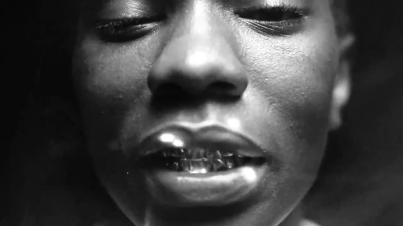 Badboymyko - Overdose (Official Music Video)