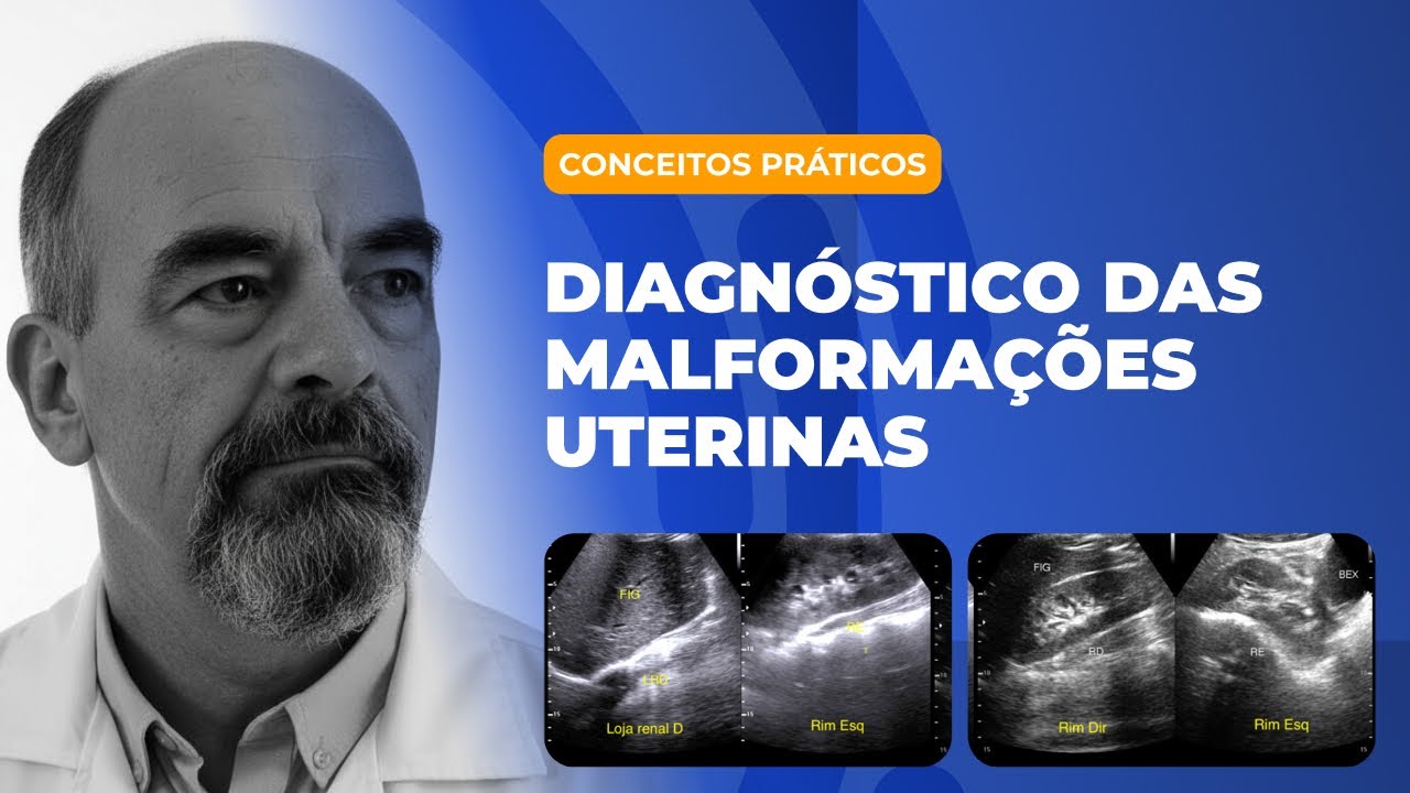 DIAGNOSTICO MALFORMACOES UTERINAS