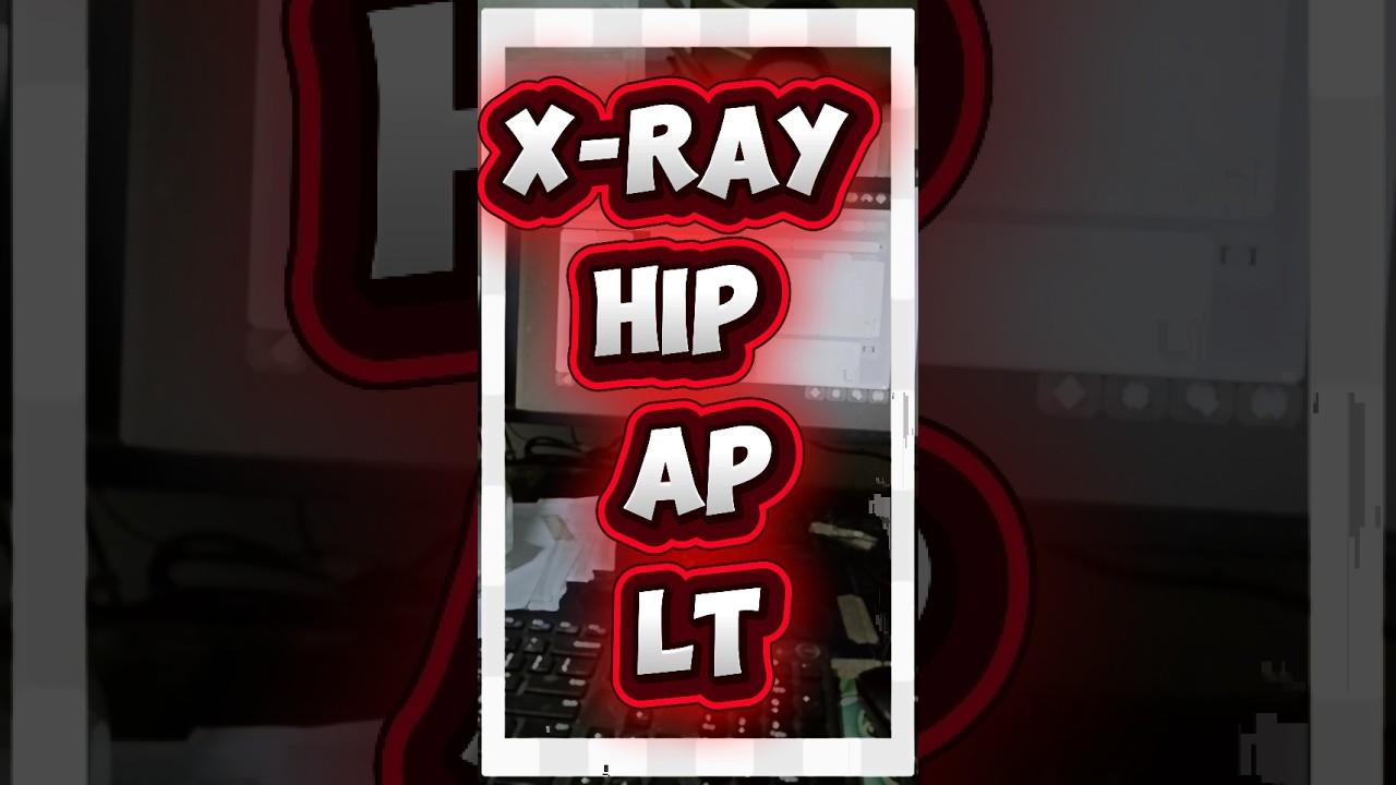 x-ray hip view🦵ap lt position