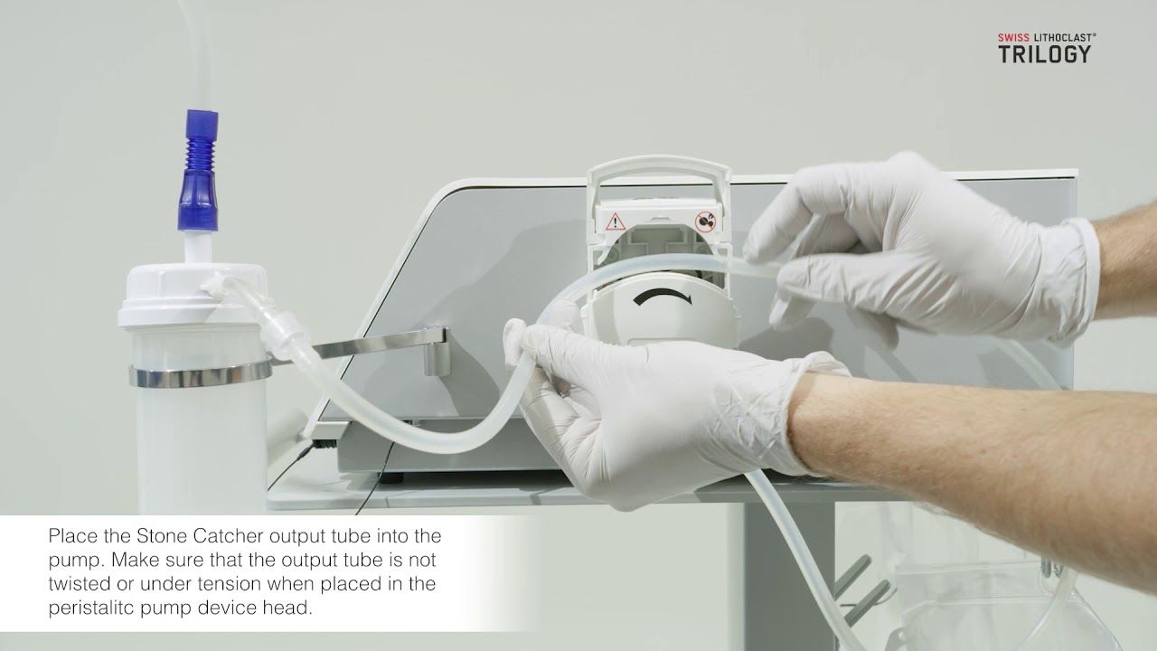 Swiss LithoClast&reg; Trilogy Setup of Accessories with two Options for Stone Catcher Video