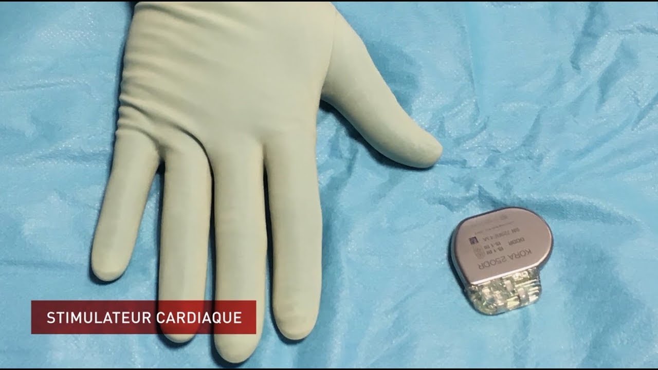Implantation d'un stimulateur cardiaque