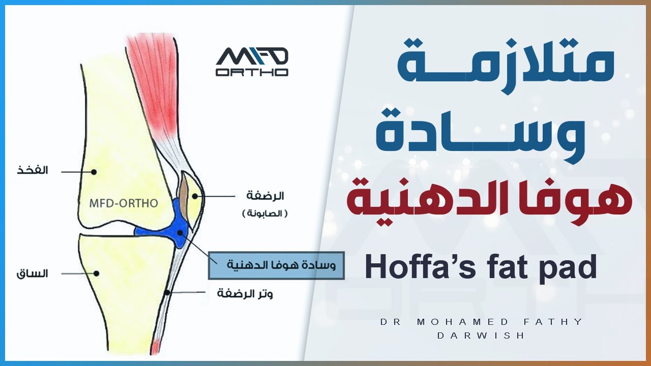 متلازمة وسادة هوفا الدهنية - Hoffa's Fat Pad | د. محمد فتحي درويش